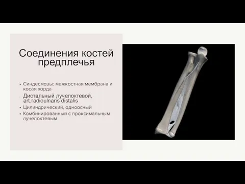 Соединения костей предплечья Синдесмозы: межкостная мембрана и косая хорда Дистальный лучелоктевой, art.radioulnaris