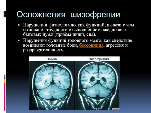 Осложнения шизофрении Нарушении физиологических функций, в связи с чем возникают трудности с