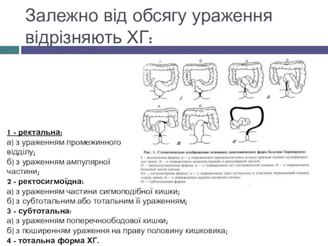 Залежно від обсягу ураження відрізняють ХГ: 1 - ректальна: а) з ураженням