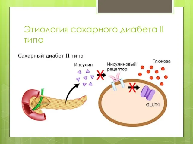 Этиология сахарного диабета II типа