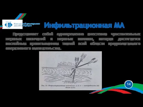 Представляет собой одновременно анестезию чувствительных нервных окончаний и нервных волокон, которая достигается