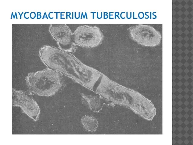 MYCOBACTERIUM TUBERCULOSIS