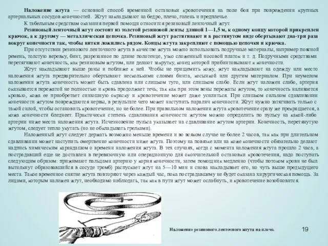 Наложение жгута — основной способ временной остановки кровотечения на поле боя при