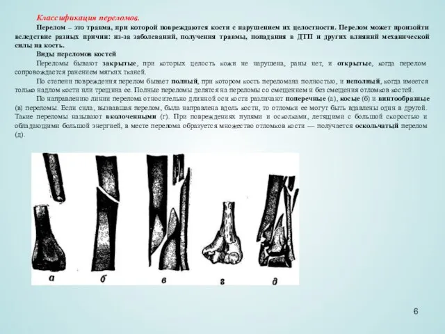 Классификация переломов. Перелом – это травма, при которой повреждаются кости с нарушением