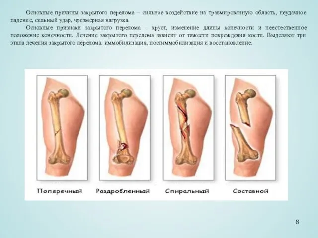 Основные причины закрытого перелома – сильное воздействие на травмированную область, неудачное падение,