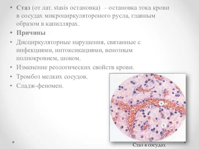 Стаз (от лат. stasis остановка) – остановка тока крови в сосудах микроциркулятороного