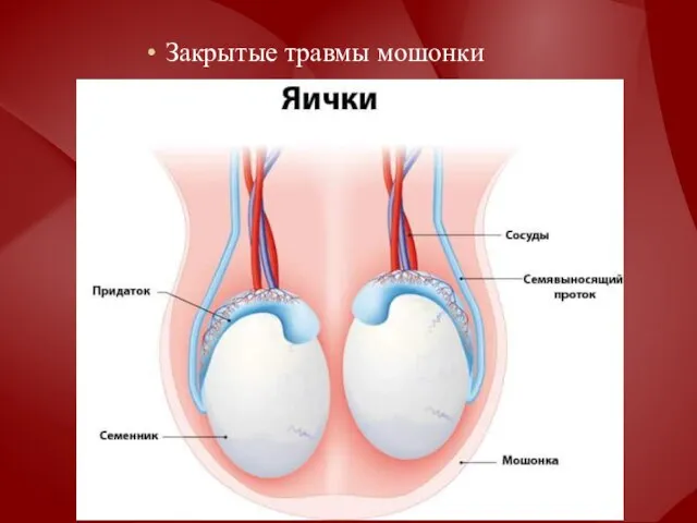 Закрытые травмы мошонки