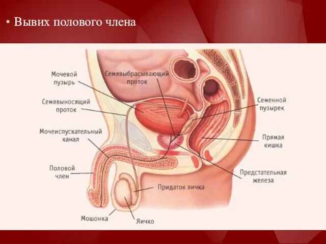 Вывих полового члена