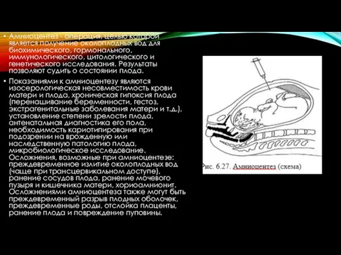 Амниоцентез - операция, целью которой является получение околоплодных вод для биохимического, гормонального,