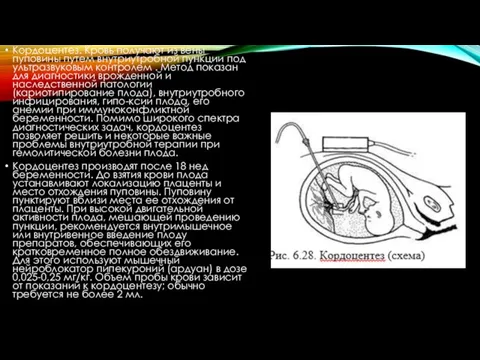 Кордоцентез. Кровь получают из вены пуповины путем внутриутробной пункции под ультразвуковым контролем