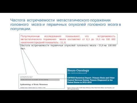 Частота встречаемости метастатического поражения головного мозга и первичных опухолей головного мозга в