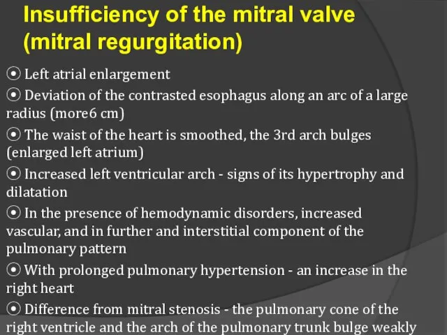 Insufficiency of the mitral valve (mitral regurgitation) ⦿ Left atrial enlargement ⦿