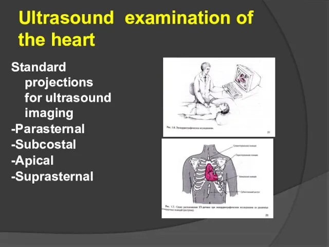 Ultrasound examination of the heart Standard projections for ultrasound imaging -Parasternal -Subcostal -Apical -Suprasternal