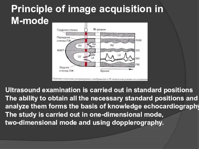 Principle of image acquisition in M-mode Ultrasound examination is carried out in