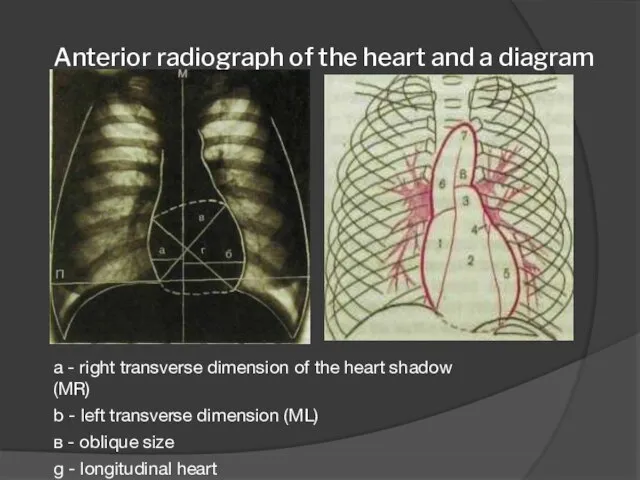 Anterior radiograph of the heart and a diagram to it a -