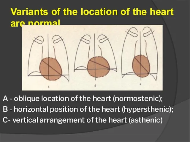 Variants of the location of the heart are normal A - oblique