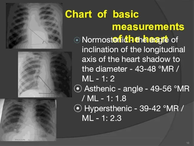 Chart of basic measurements of the heart ⦿ Normostenic - the angle