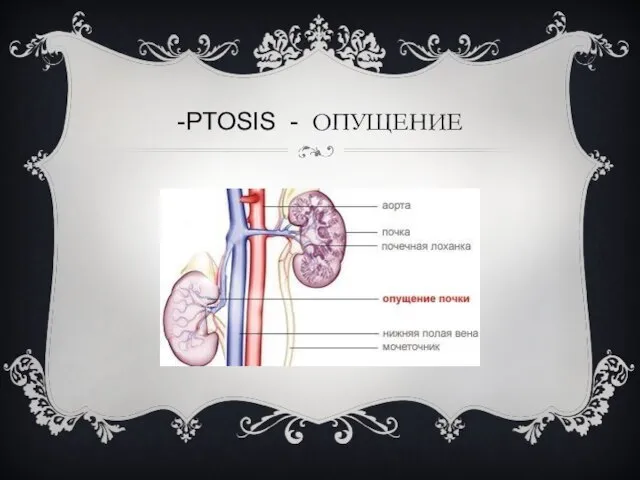 -PTOSIS - ОПУЩЕНИЕ