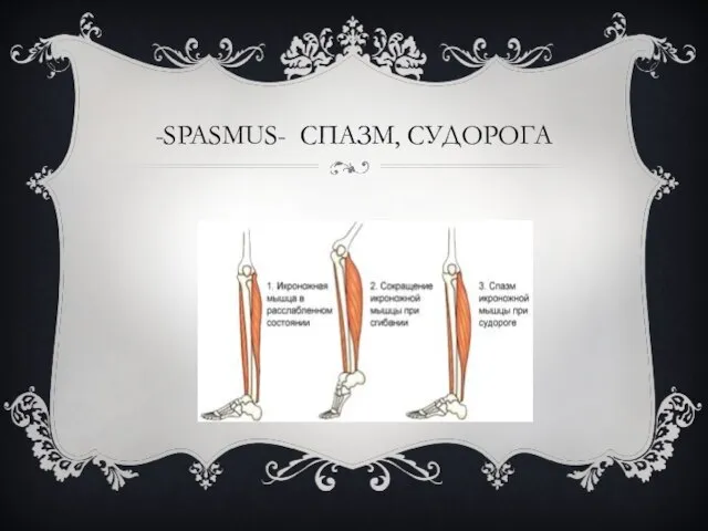 -SPASMUS- СПАЗМ, СУДОРОГА