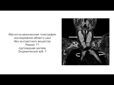 -Магнитно-резонансная томография -исследование области шеи -без контрастного вещества -Режим: Т1 -Щитовидная железа -Эндемический зоб- ?