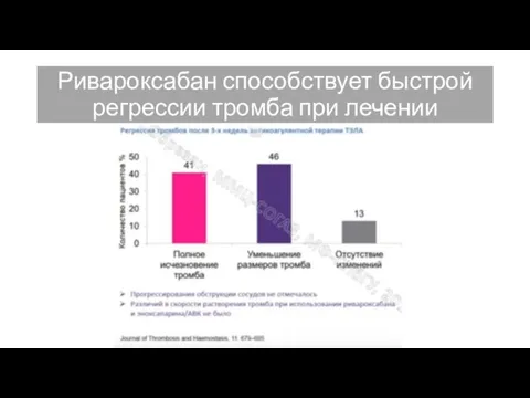 Ривароксабан способствует быстрой регрессии тромба при лечении