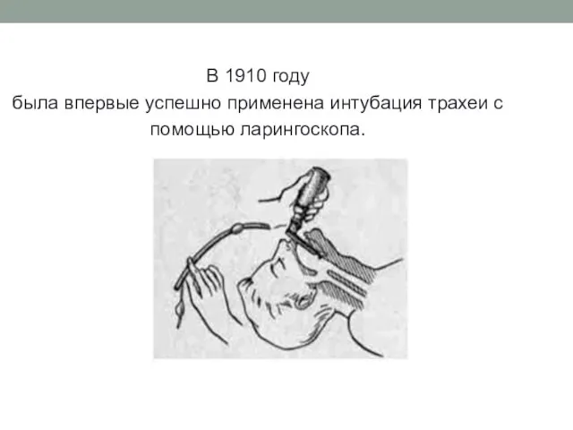 В 1910 году была впервые успешно применена интубация трахеи с помощью ларингоскопа.