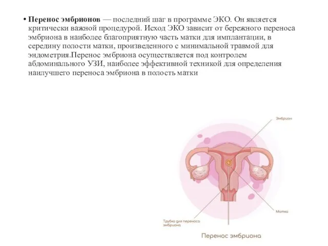 Перенос эмбрионов — последний шаг в программе ЭКО. Он является критически важной