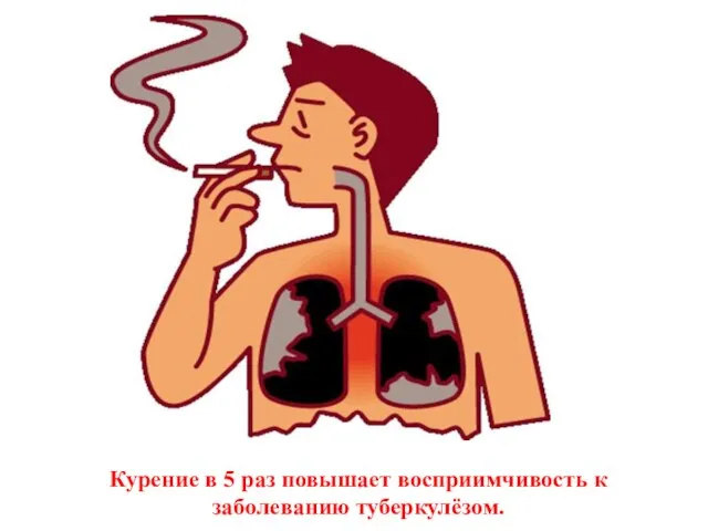 Курение в 5 раз повышает восприимчивость к заболеванию туберкулёзом.