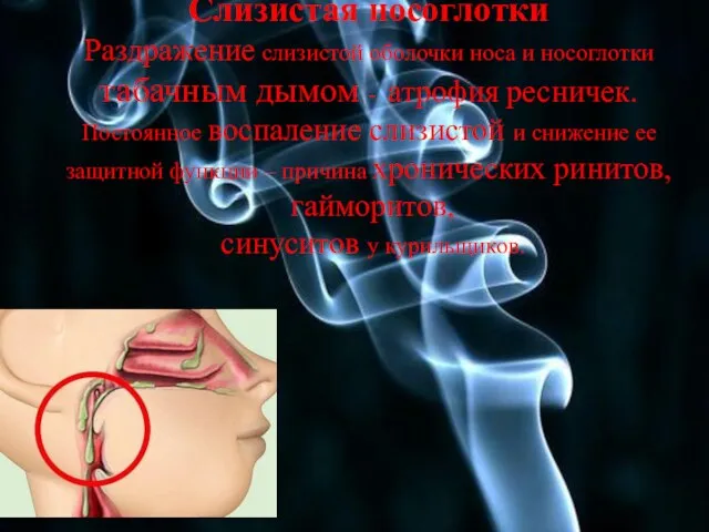 Слизистая носоглотки Раздражение слизистой оболочки носа и носоглотки табачным дымом - атрофия
