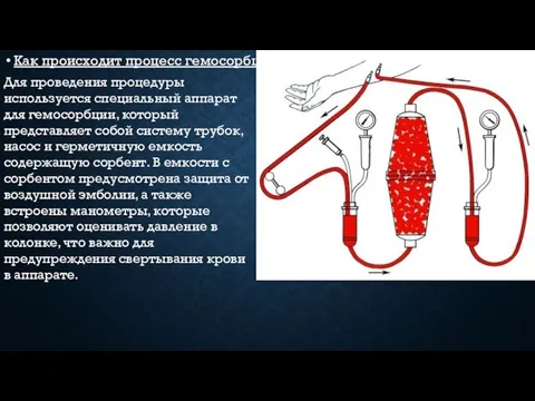 Как происходит процесс гемосорбции: Для проведения процедуры используется специальный аппарат для гемосорбции,