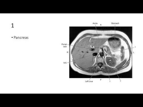 1 Pancreas