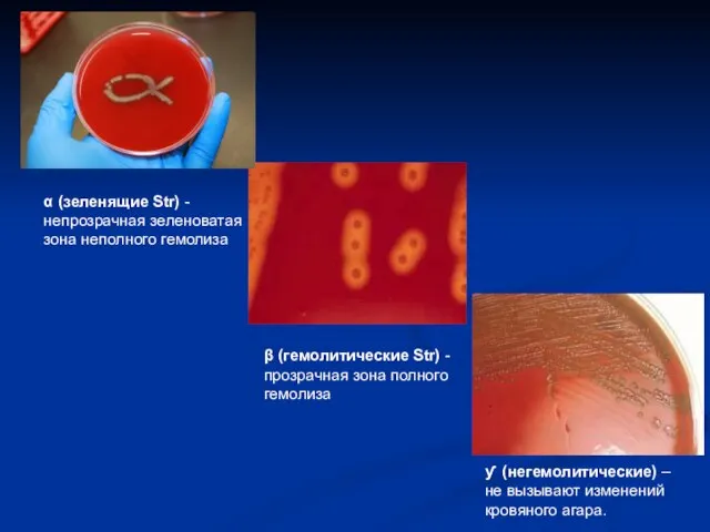 α (зеленящие Str) - непрозрачная зеленоватая зона неполного гемолиза β (гемолитические Str)