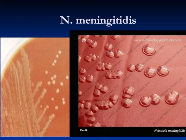 N. meningitidis