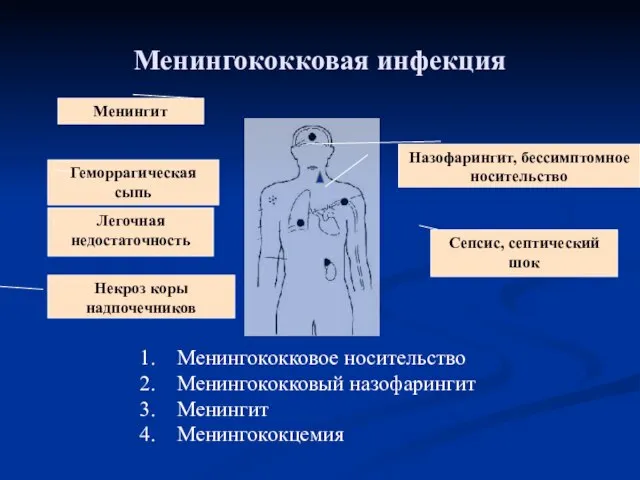 Менингококковая инфекция Назофарингит, бессимптомное носительство Менингит Геморрагическая сыпь Сепсис, септический шок Легочная