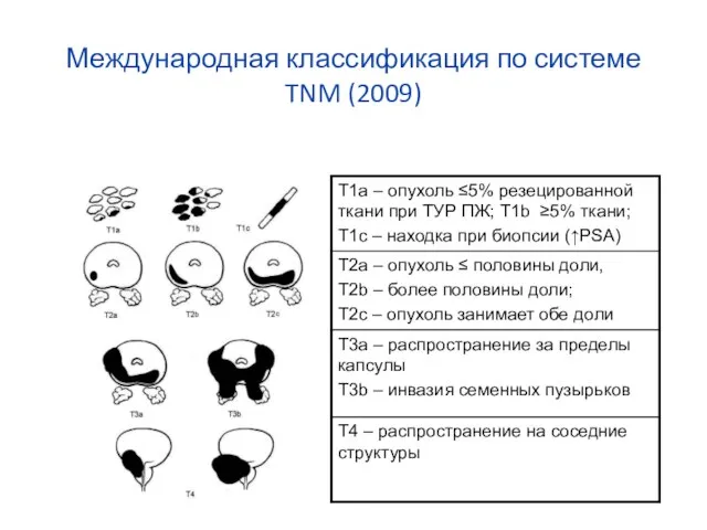 Международная классификация по системе TNM (2009)