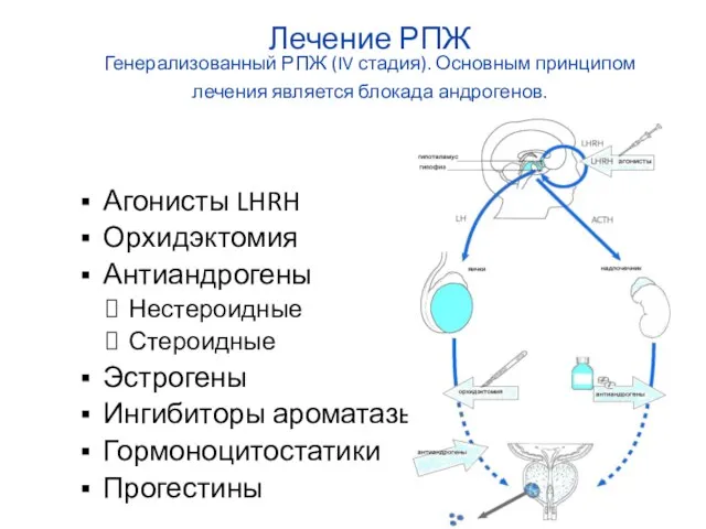 Лечение РПЖ Генерализованный РПЖ (IV стадия). Основным принципом лечения является блокада андрогенов.