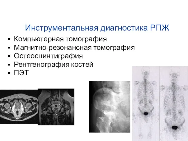 Инструментальная диагностика РПЖ Компьютерная томография Магнитно-резонансная томография Остеосцинтиграфия Рентгенография костей ПЭТ