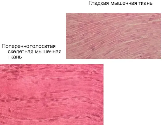Поперечнополосатая скелетная мышечная ткань Гладкая мышечная ткань