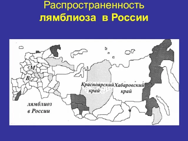 Распространенность лямблиоза в России