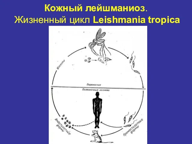 Кожный лейшманиоз. Жизненный цикл Leishmania tropica