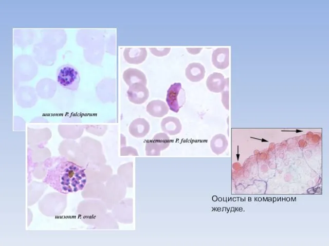 Ооцисты в комарином желудке.