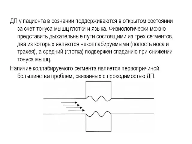 ДП у пациента в сознании поддерживаются в открытом состоянии за счет тонуса