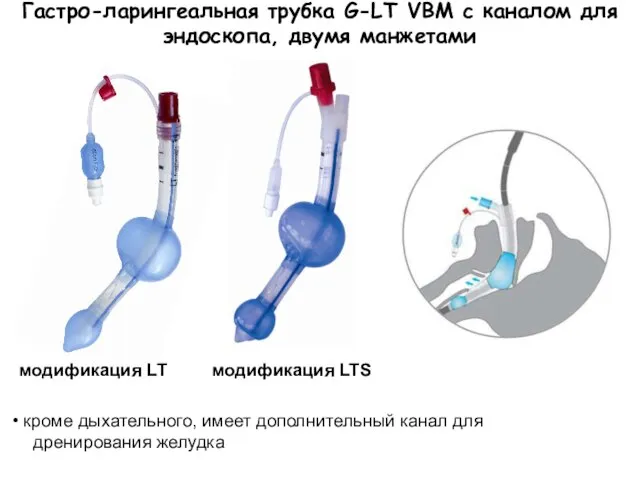 Гастро-ларингеальная трубка G-LT VBM с каналом для эндоскопа, двумя манжетами модификация LT
