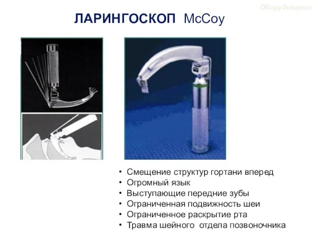 Смещение структур гортани вперед Огромный язык Выступающие передние зубы Ограниченная подвижность шеи