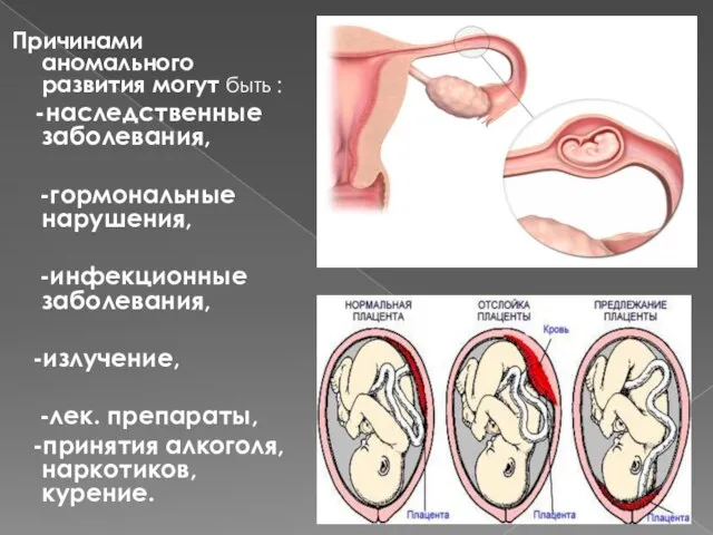 Причинами аномального развития могут быть : -наследственные заболевания, -гормональные нарушения, -инфекционные заболевания,