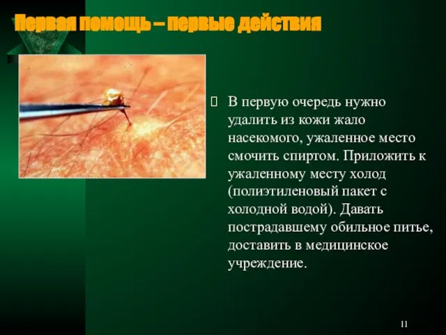 В первую очередь нужно удалить из кожи жало насекомого, ужаленное место смочить