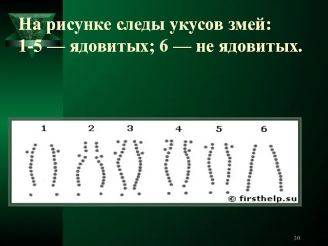 На рисунке следы укусов змей: 1-5 — ядовитых; 6 — не ядовитых.