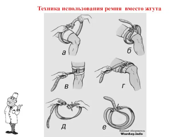 Техника использования ремня вместо жгута