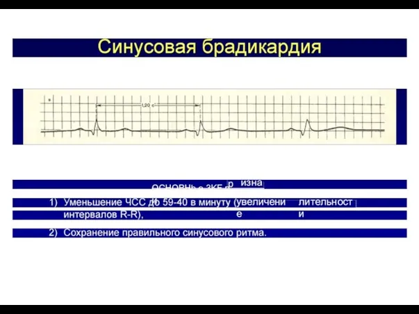 OCHOBHb е 3KF п изна и увеличение лительности