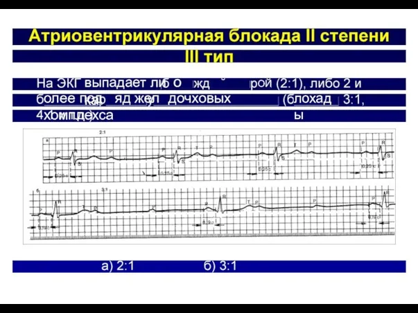 выпадает ли о ка ОИ олее под яд жел дочховых хомплехса лохады